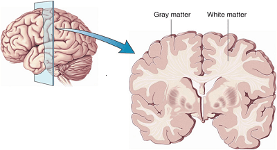 picture of a brain's gray and white matter